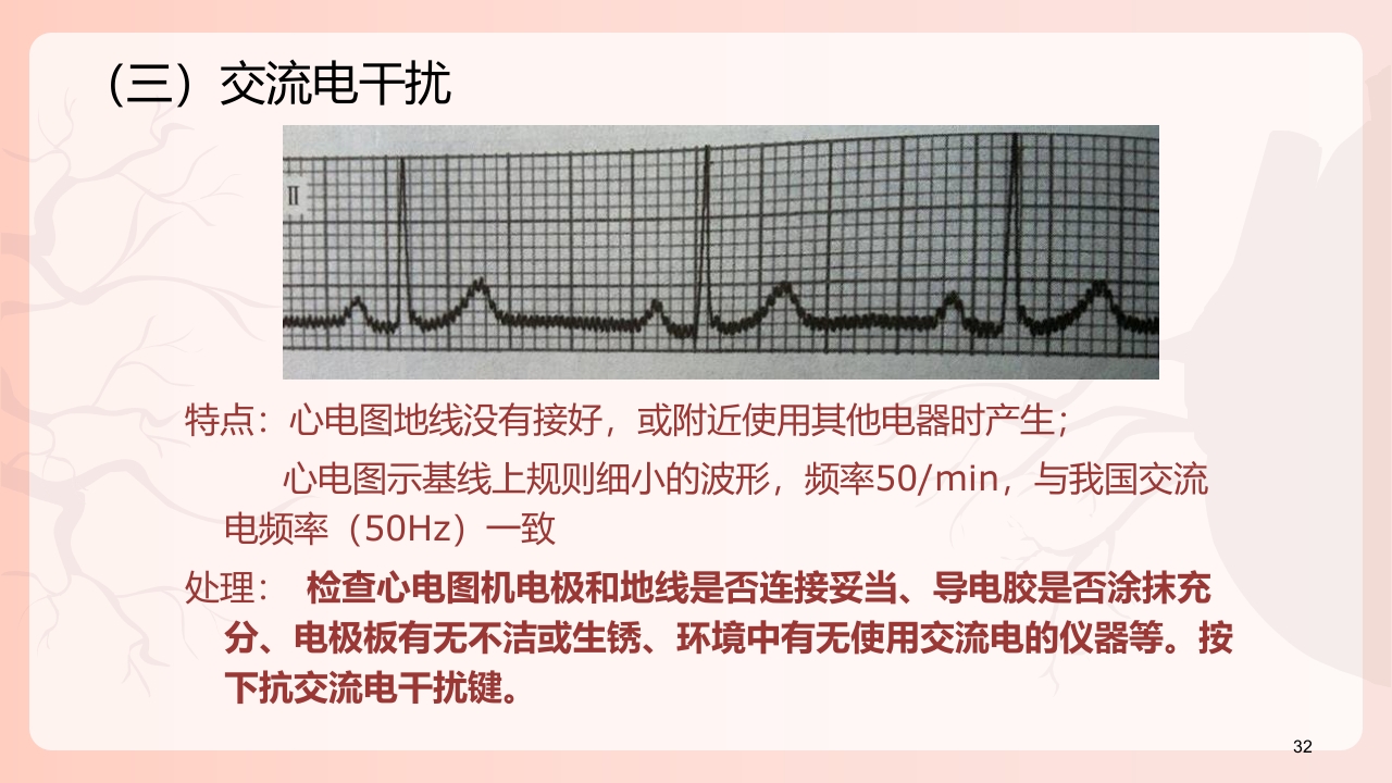 心电图机的正确使用PPT课件下载33