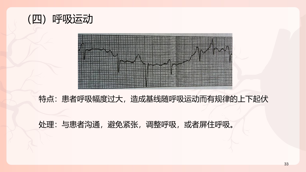 心电图机的正确使用PPT课件下载34