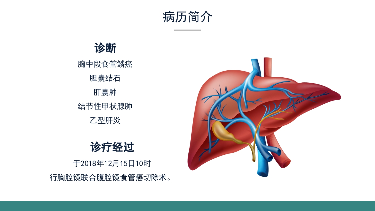 乙肝大三阳食管癌术后的护理查房PPT课件18