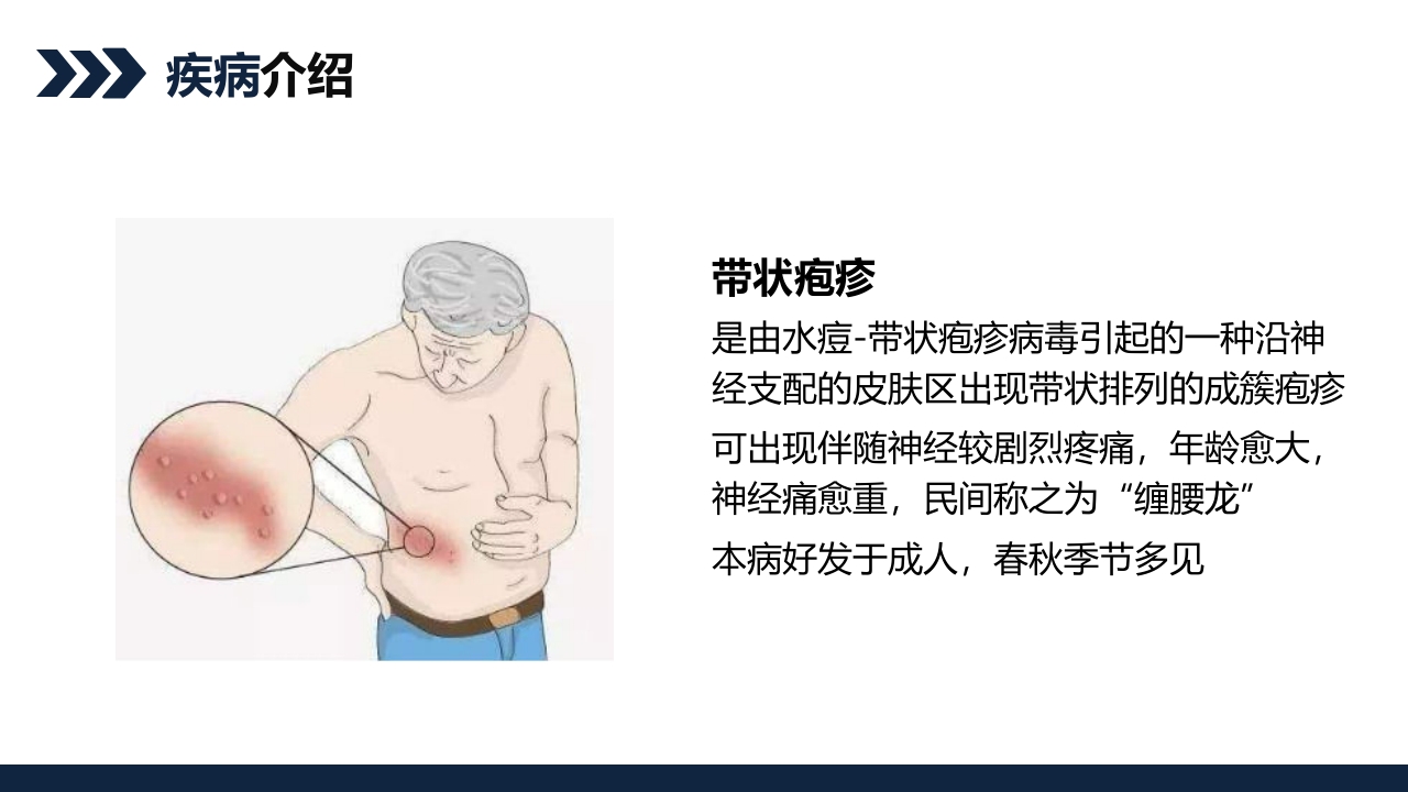 带状疱疹后遗神经痛护理查房PPT课件4
