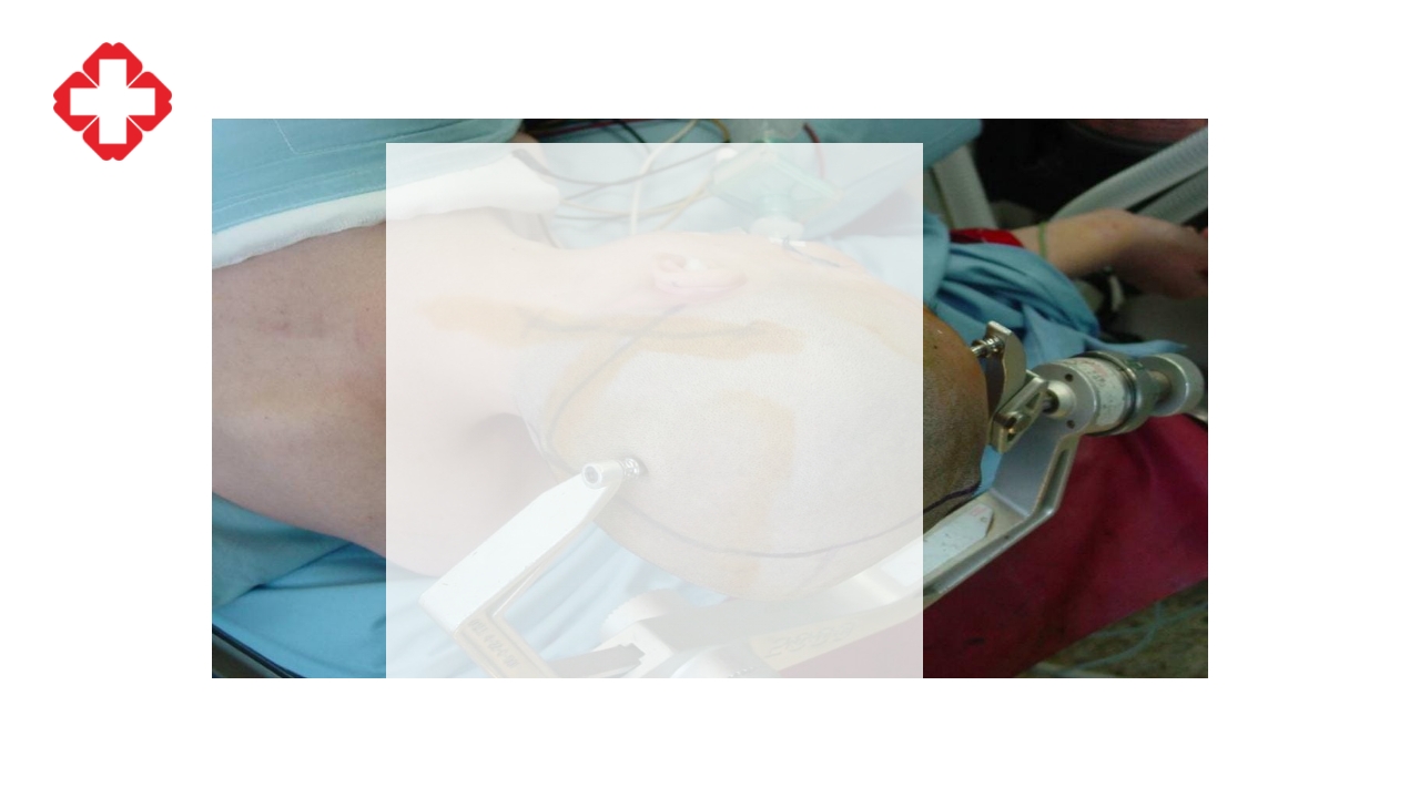 神经外科手术配合ppt大脑半球胶质瘤PPT课件20