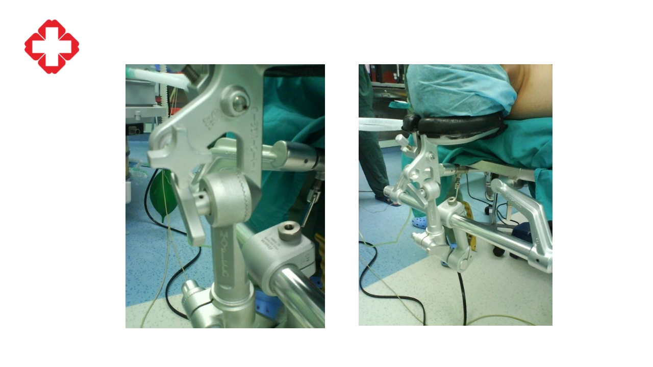 神经外科手术配合ppt大脑半球胶质瘤PPT课件25