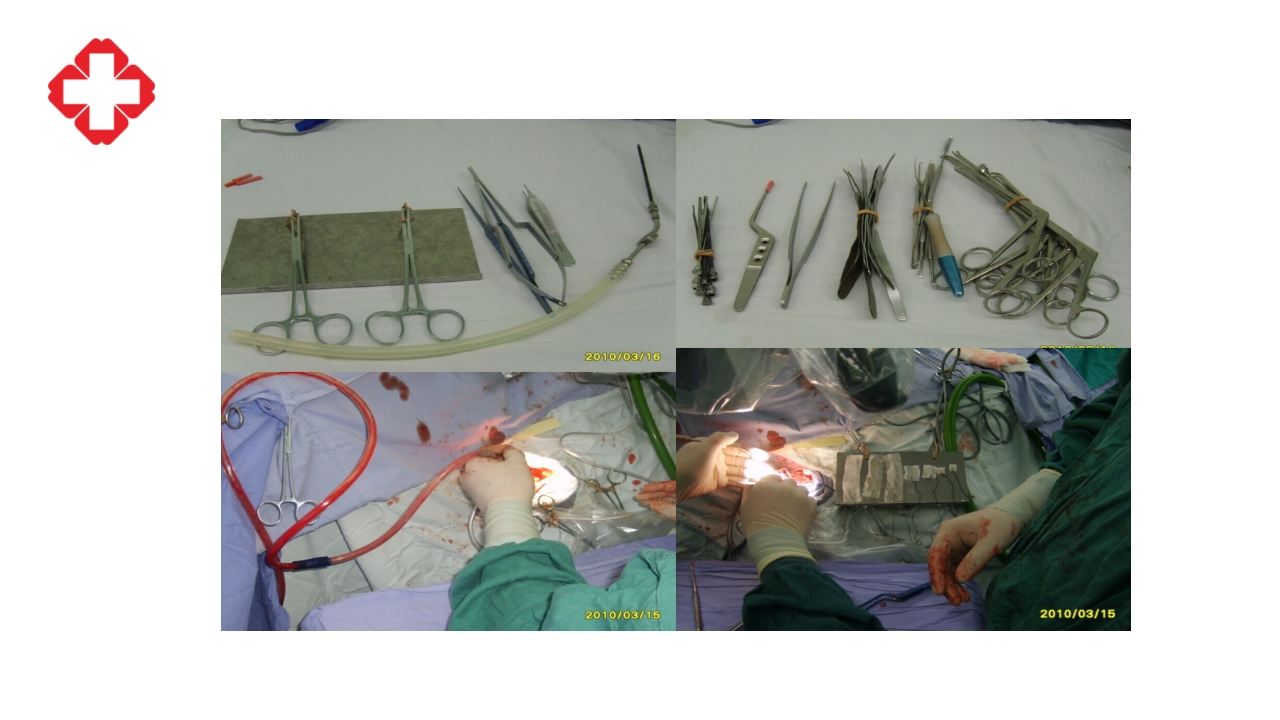 神经外科手术配合ppt大脑半球胶质瘤PPT课件45