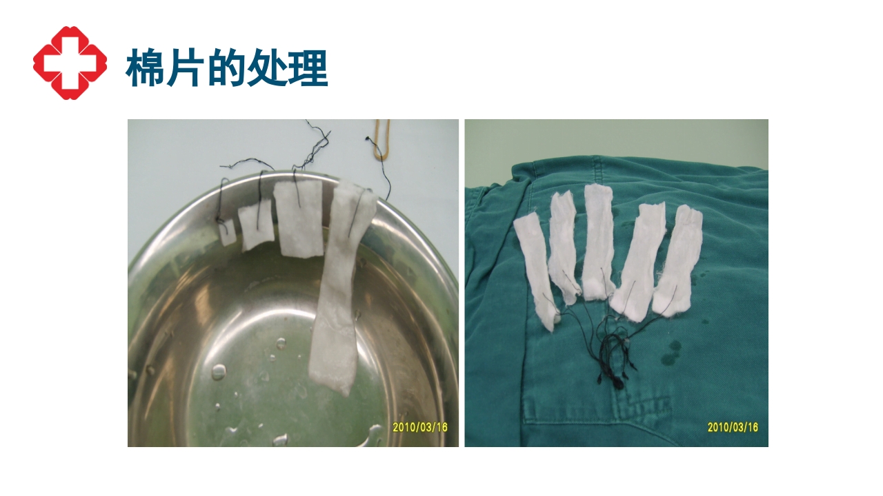 神经外科手术配合ppt大脑半球胶质瘤PPT课件47