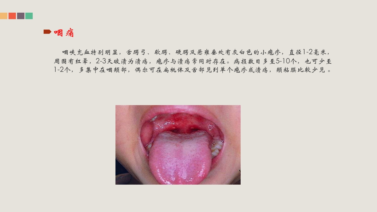 疱疹性咽峡炎的管理和中医药治疗PPT课件7