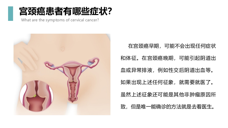 宫颈癌科普知识PPT课件6