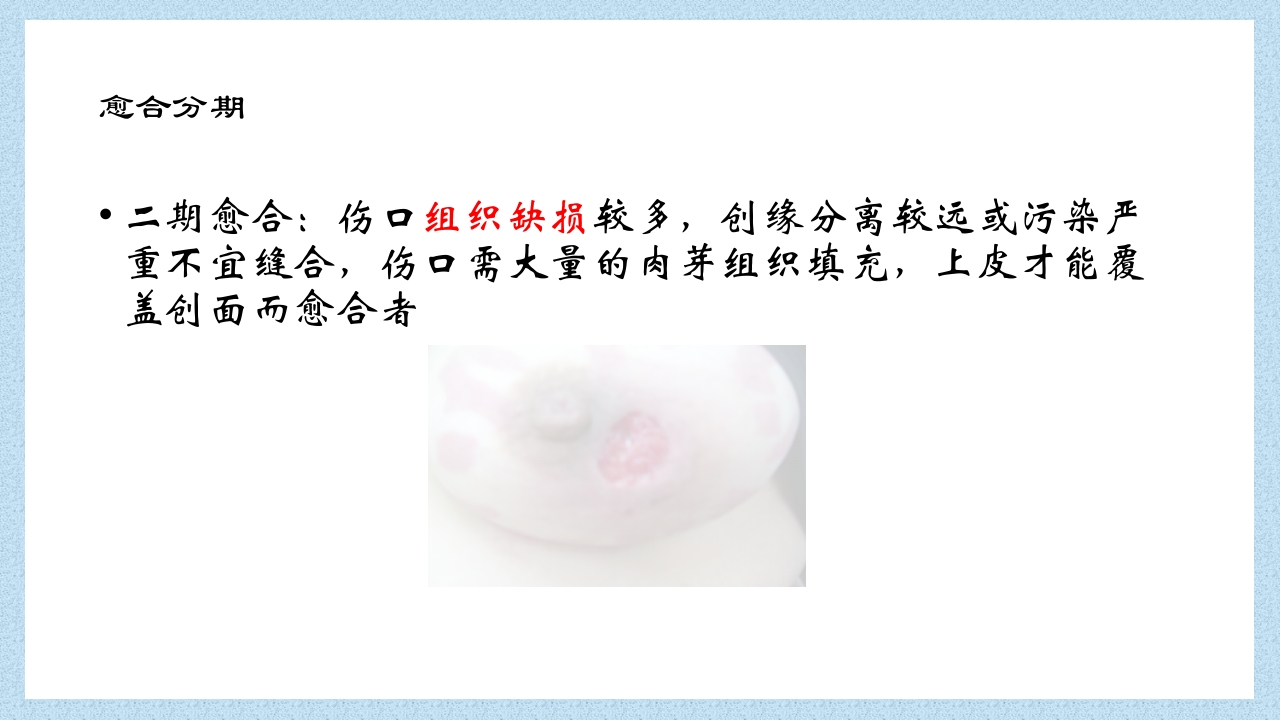 外科常见伤口换药技术PPT课件15