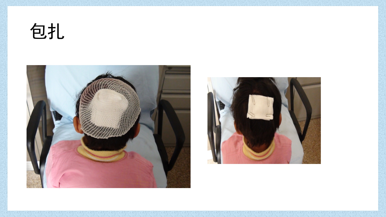 外科常见伤口换药技术PPT课件64