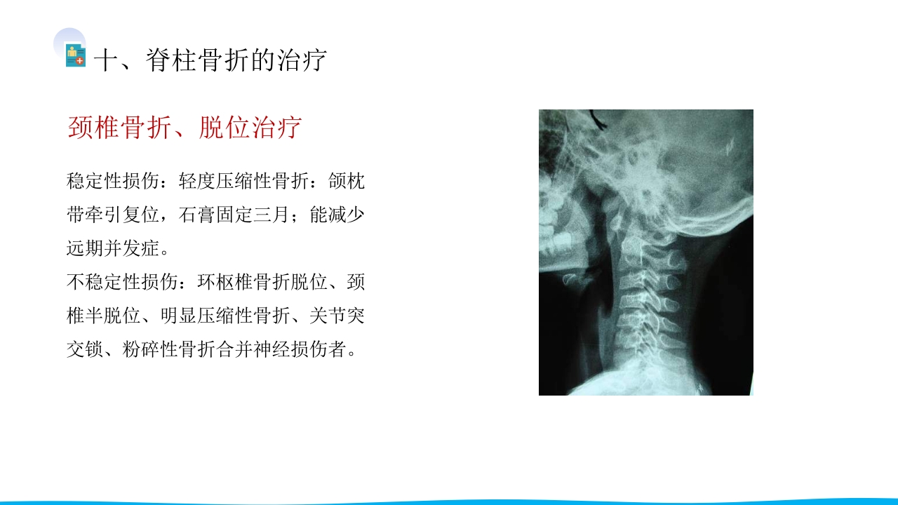 脊柱骨折与脊髓损伤PPT课件下载18