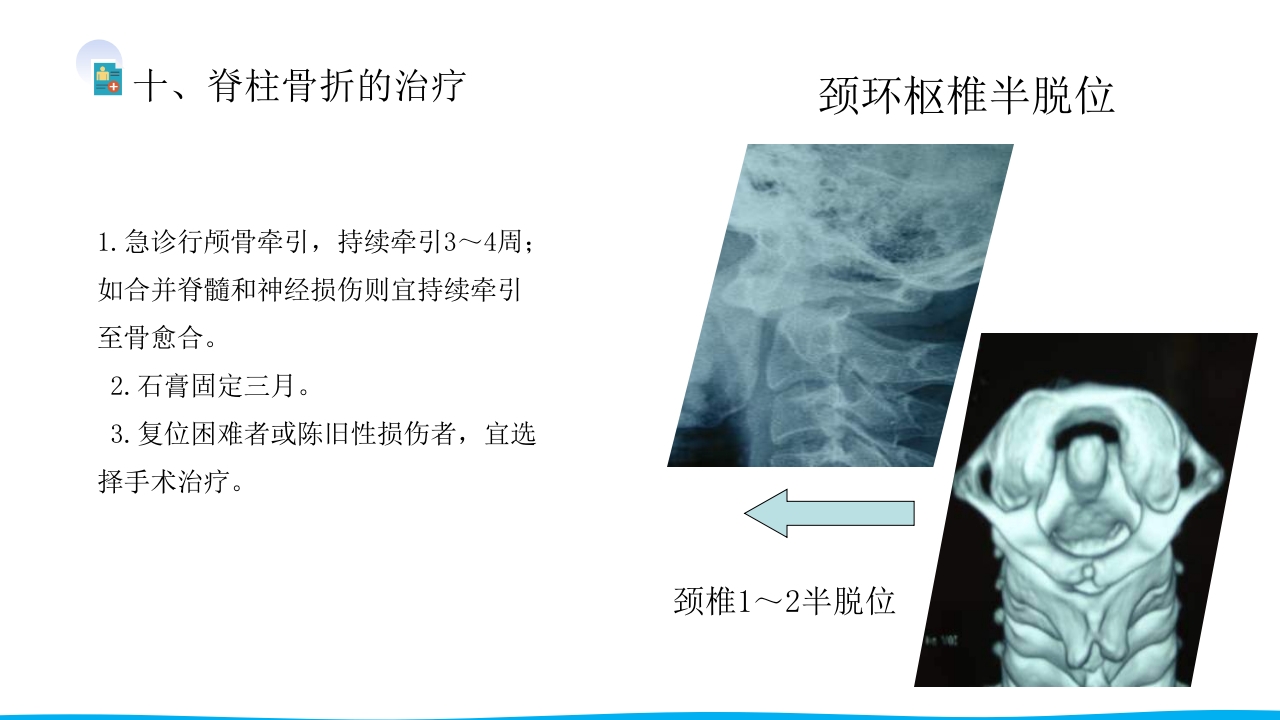 脊柱骨折与脊髓损伤PPT课件下载19