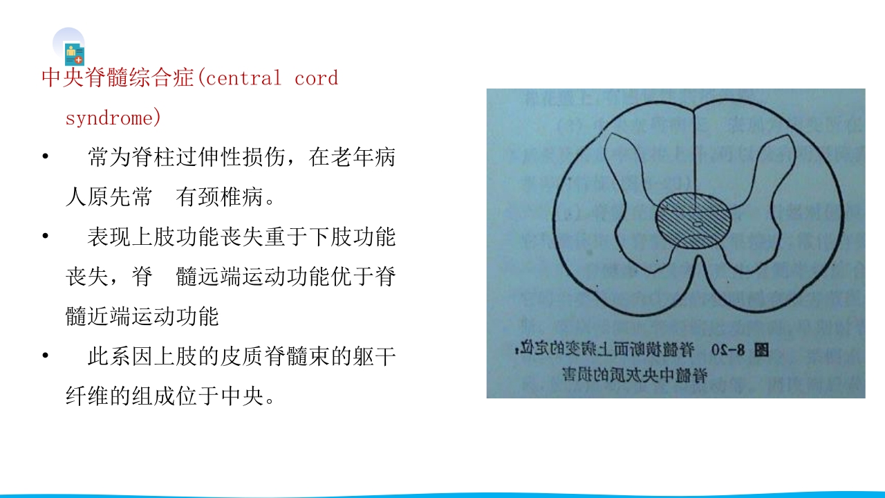 脊柱骨折与脊髓损伤PPT课件下载44