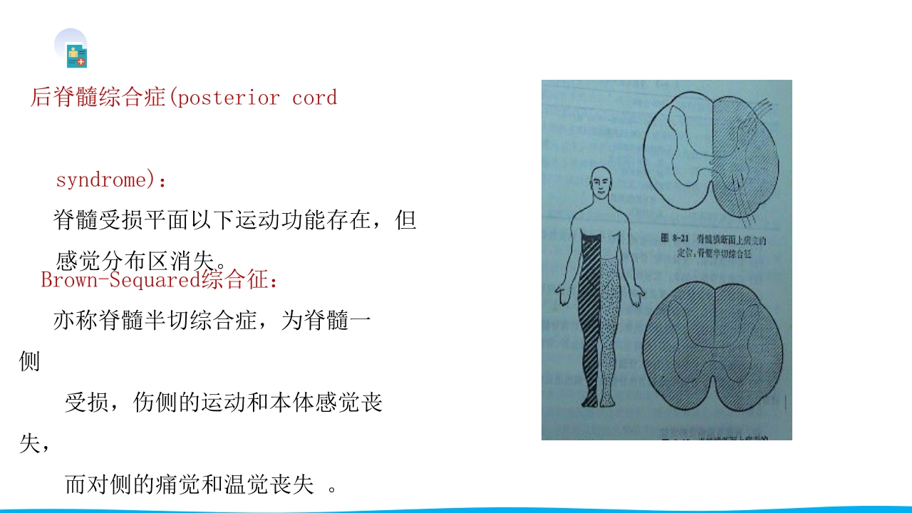 脊柱骨折与脊髓损伤PPT课件下载45