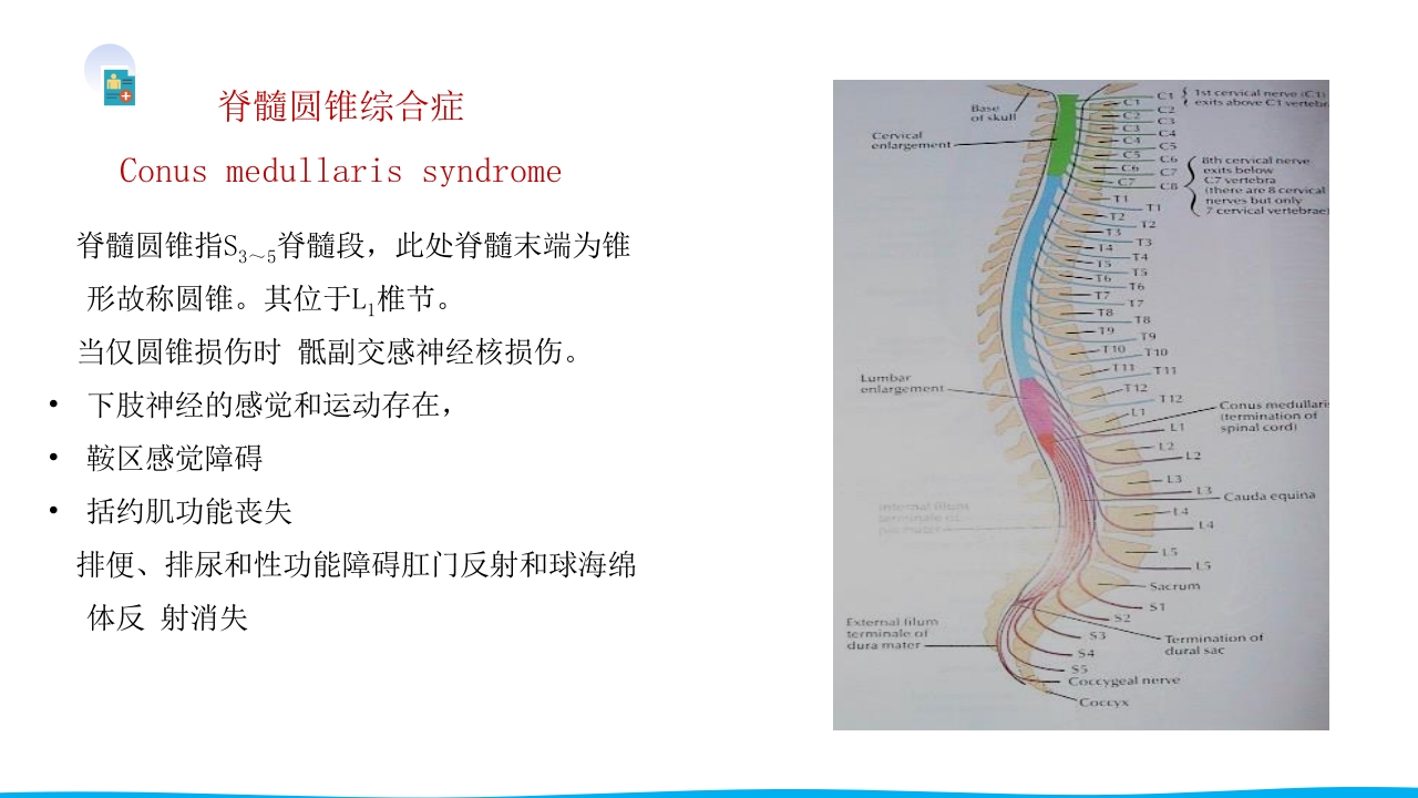 脊柱骨折与脊髓损伤PPT课件下载46