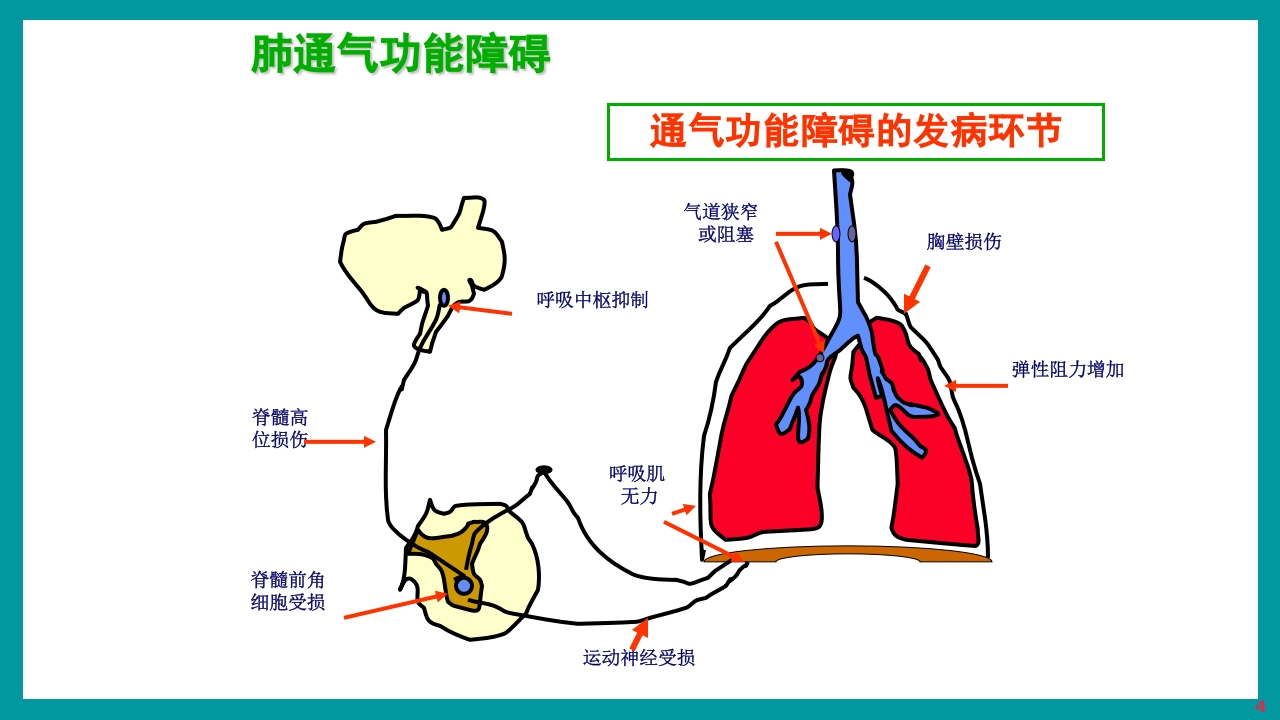 酸碱平衡判断·血气分析六步法PPT课件下载4