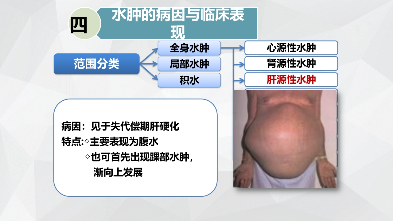水肿的分类及护理PPT课件下载18