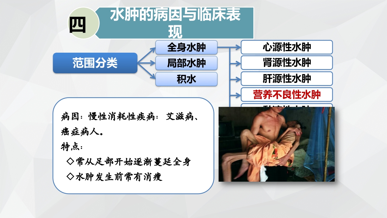 水肿的分类及护理PPT课件下载20