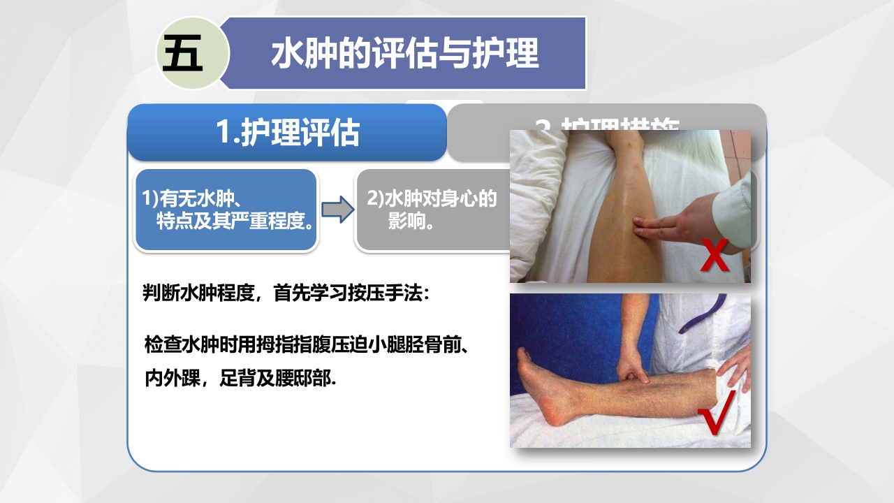水肿的分类及护理PPT课件下载22