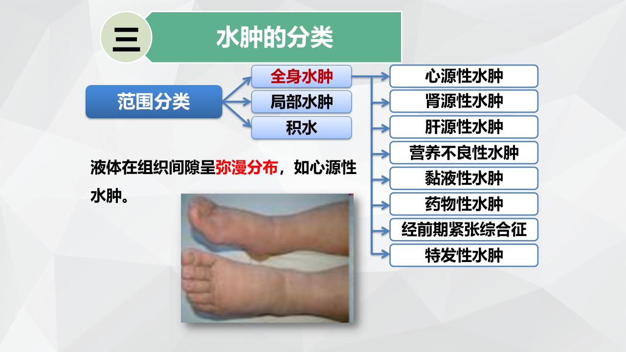 水肿的分类及护理PPT课件下载9