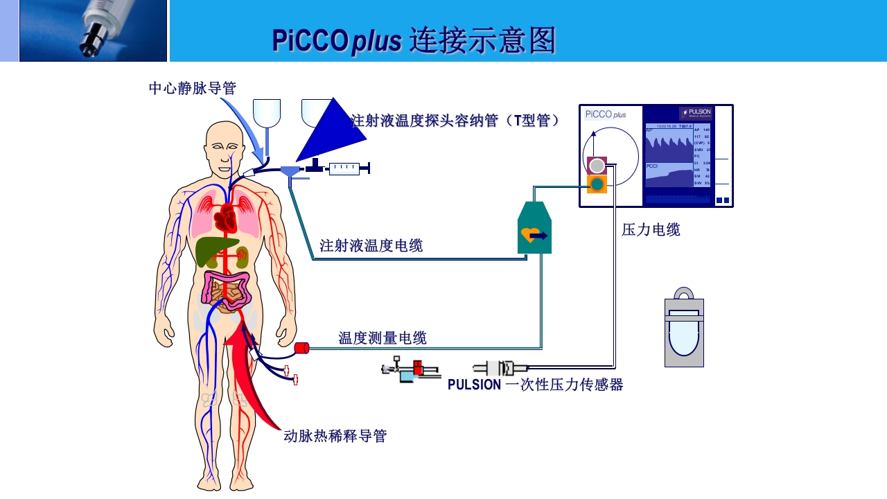 高原肺水肿的监测与治疗PPT课件下载22