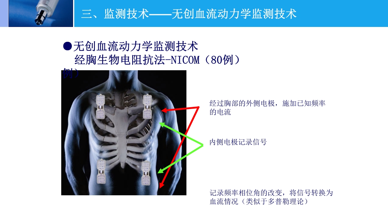 高原肺水肿的监测与治疗PPT课件下载25