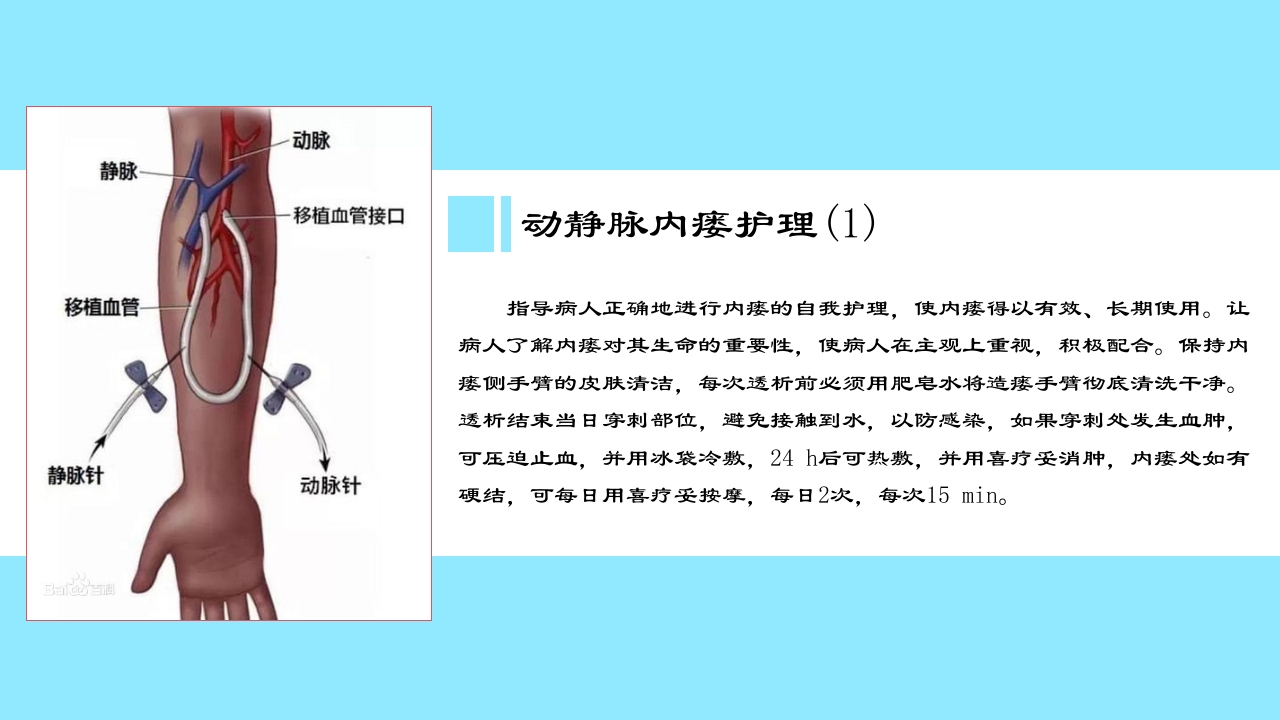 急慢性肾功能衰竭患者肾脏替代治疗方式之一血透病人的护理PPT课件15