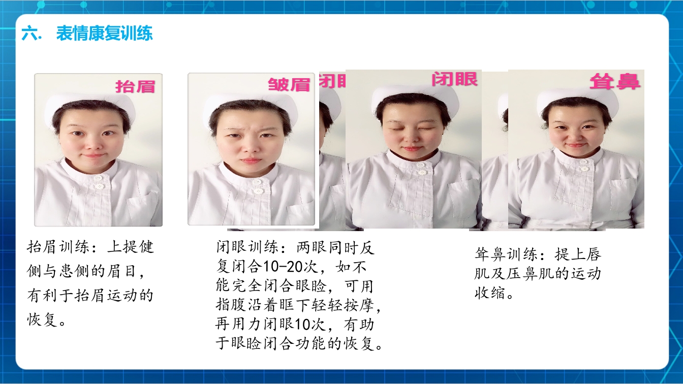 面瘫病人的护理PPT课件下载12