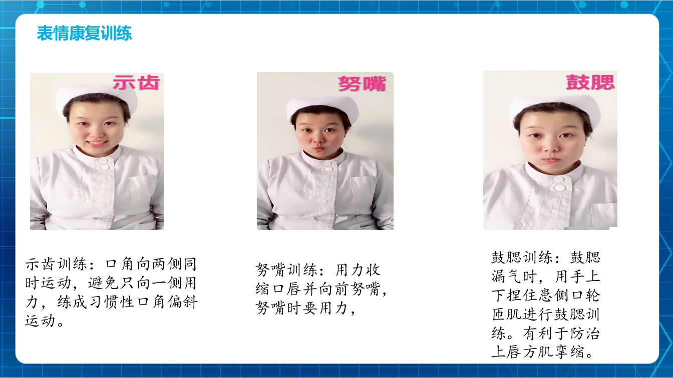 面瘫病人的护理PPT课件下载13