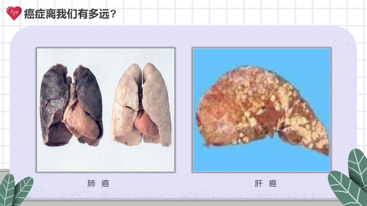癌症的认识和预防宣传讲座科普PPT课件8