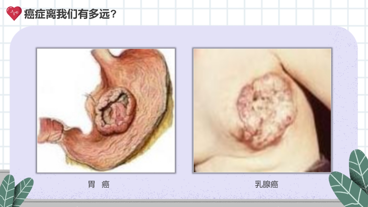 癌症的认识和预防宣传讲座科普PPT课件9