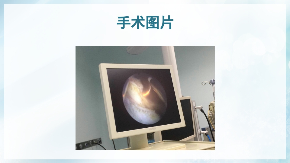 前列腺增生症的治疗及护理PPT课件15