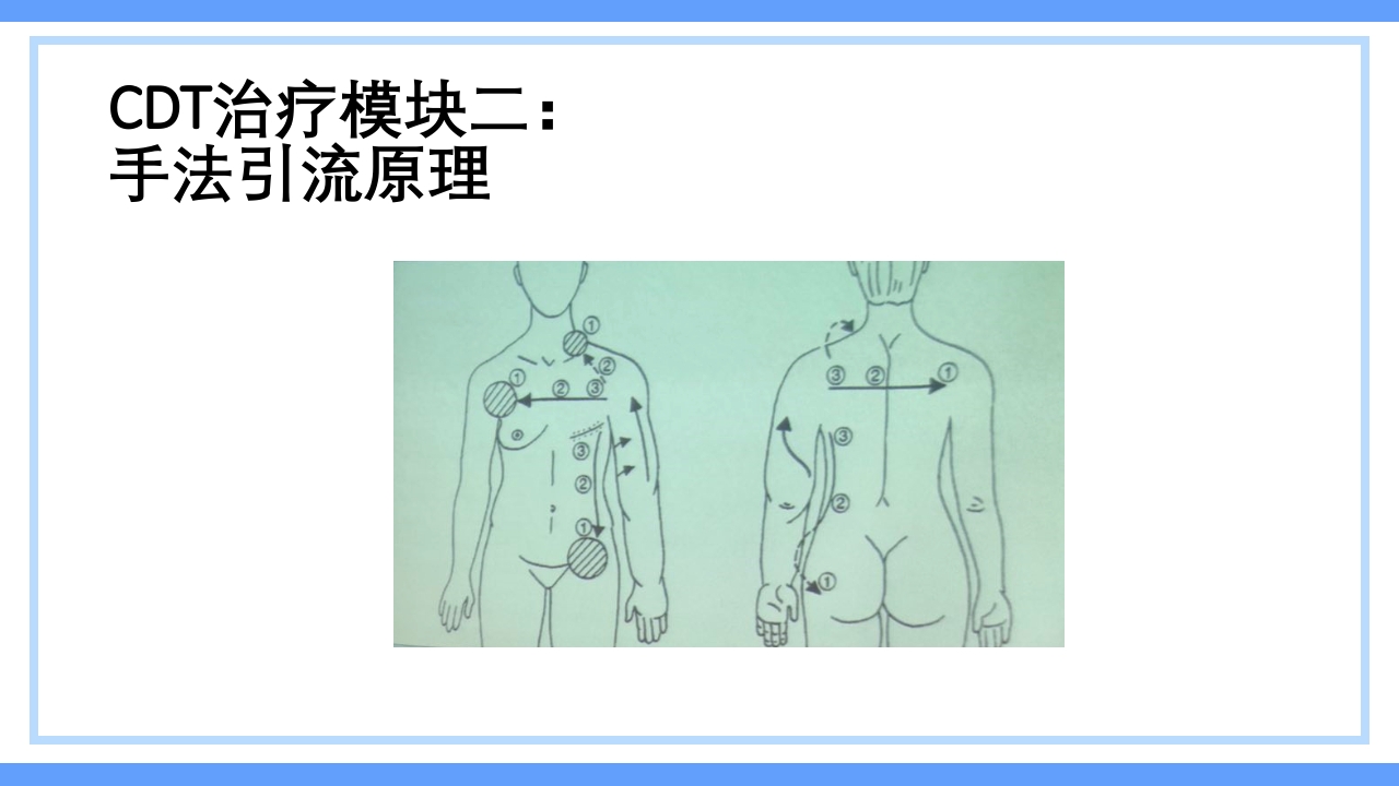 淋巴水肿及CDT标准化治疗PPT课件下载21