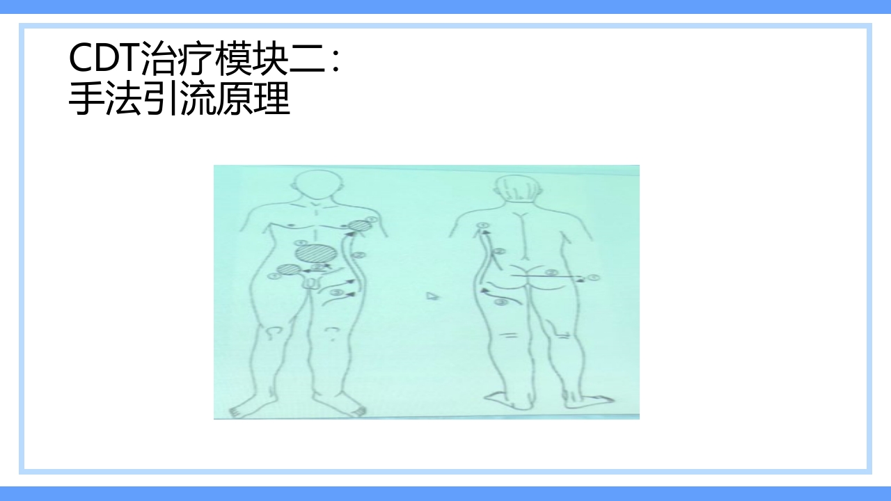 淋巴水肿及CDT标准化治疗PPT课件下载22