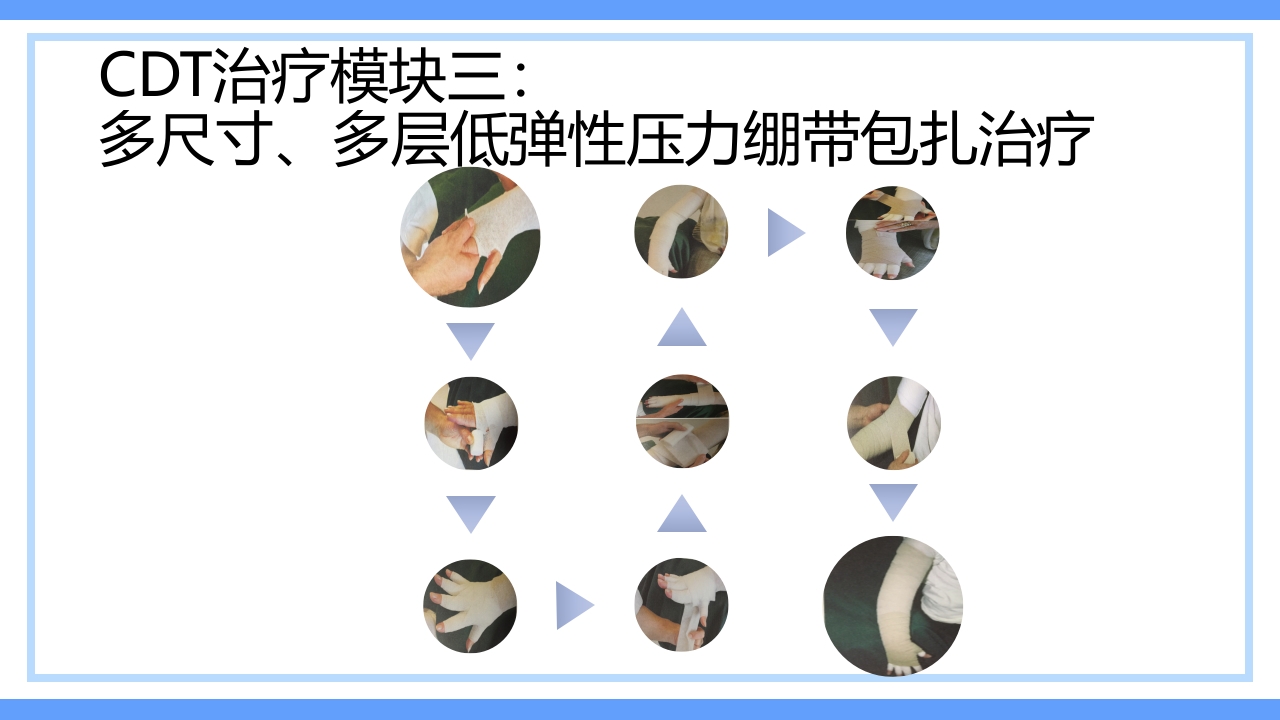 淋巴水肿及CDT标准化治疗PPT课件下载26