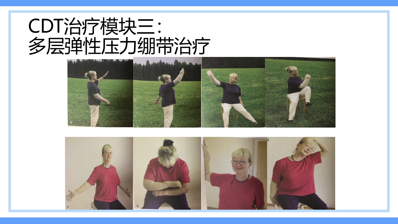 淋巴水肿及CDT标准化治疗PPT课件下载27