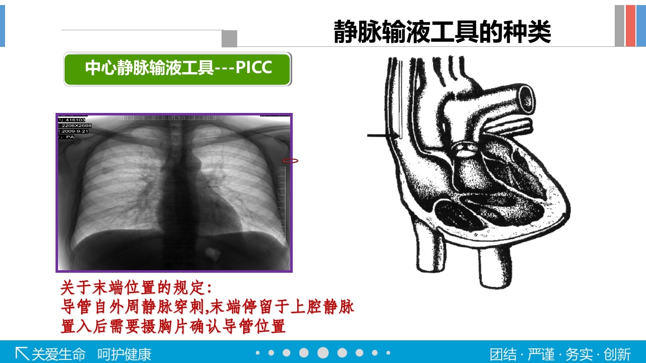 静脉输液工具的选择PPT课件30