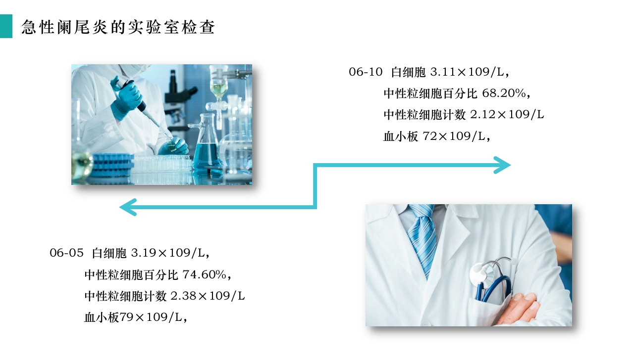 急性阑尾炎护理查房PPT课件14