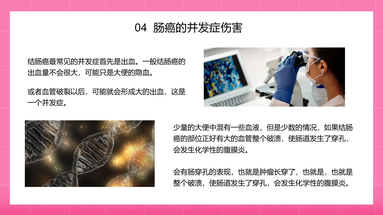 怎样预防肠癌医学知识PPT课件20