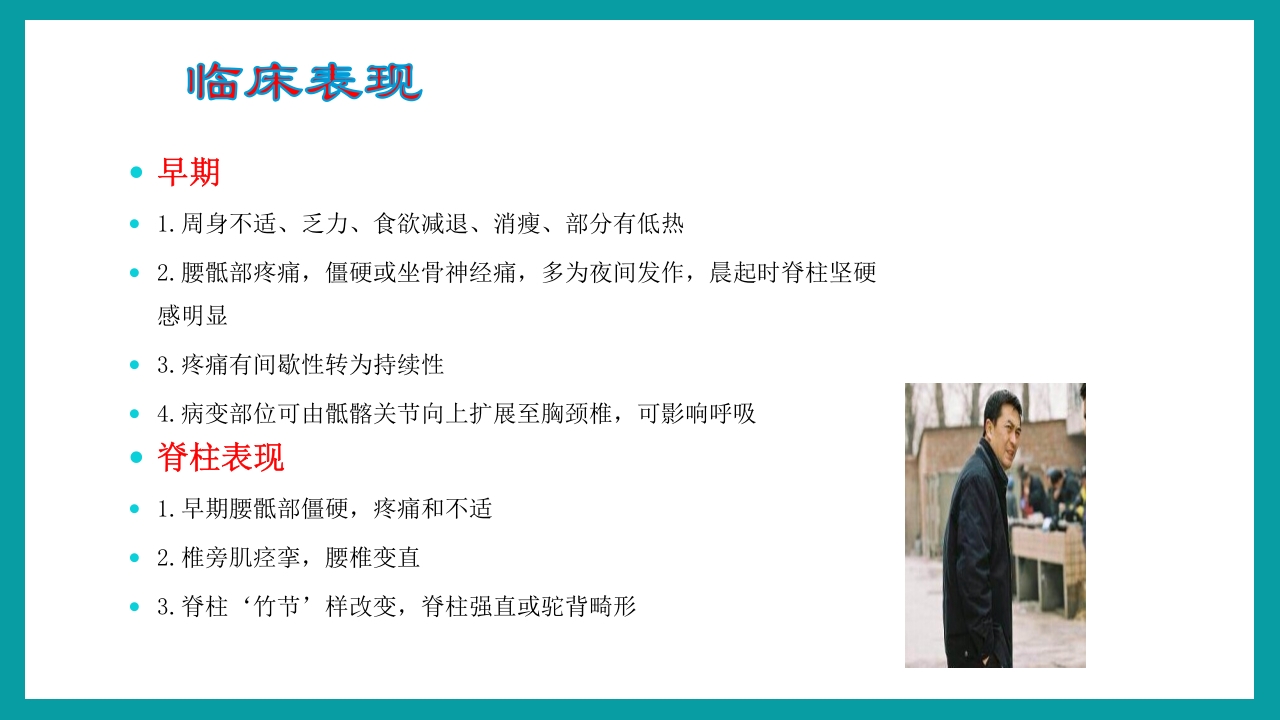 强直性脊柱炎护理查房PPT课件10