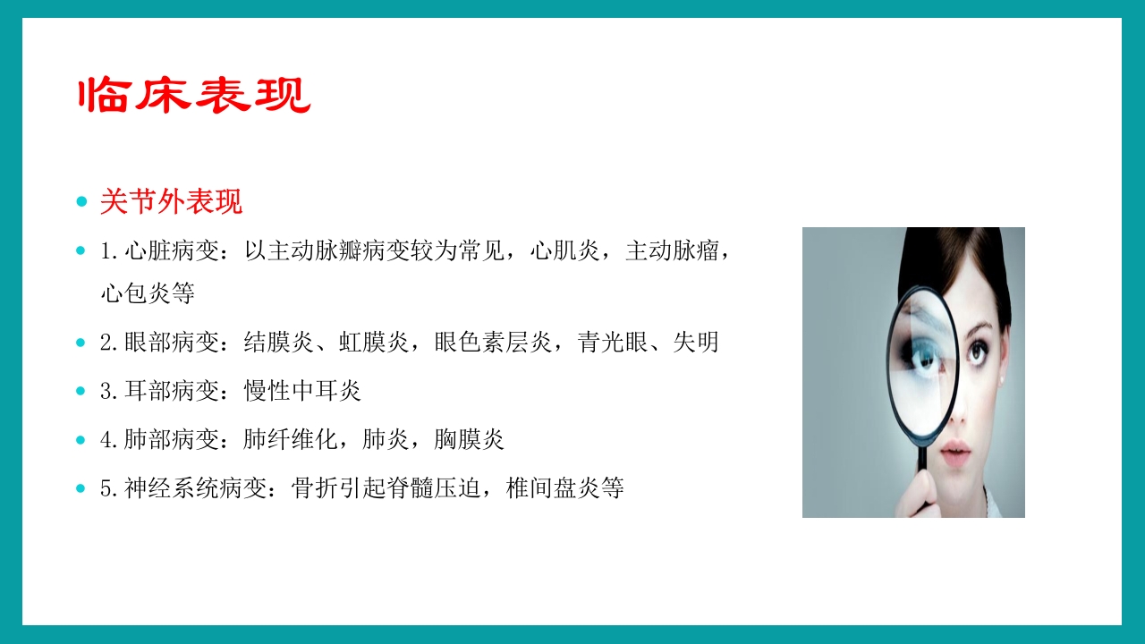 强直性脊柱炎护理查房PPT课件13