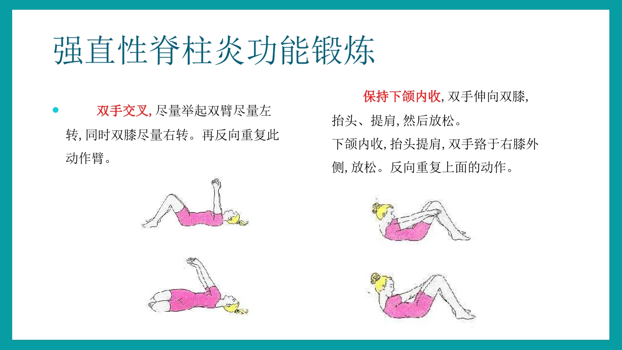 强直性脊柱炎护理查房PPT课件30