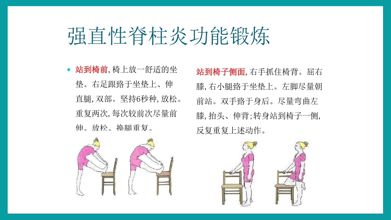 强直性脊柱炎护理查房PPT课件34