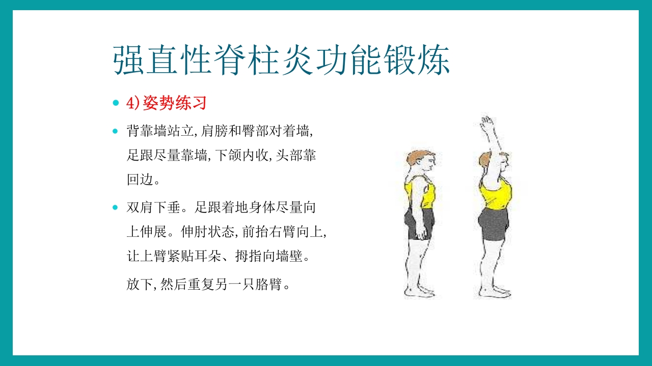 强直性脊柱炎护理查房PPT课件35