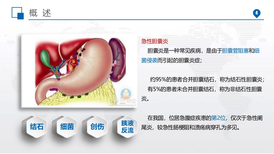 急性胆囊炎PPT课件4