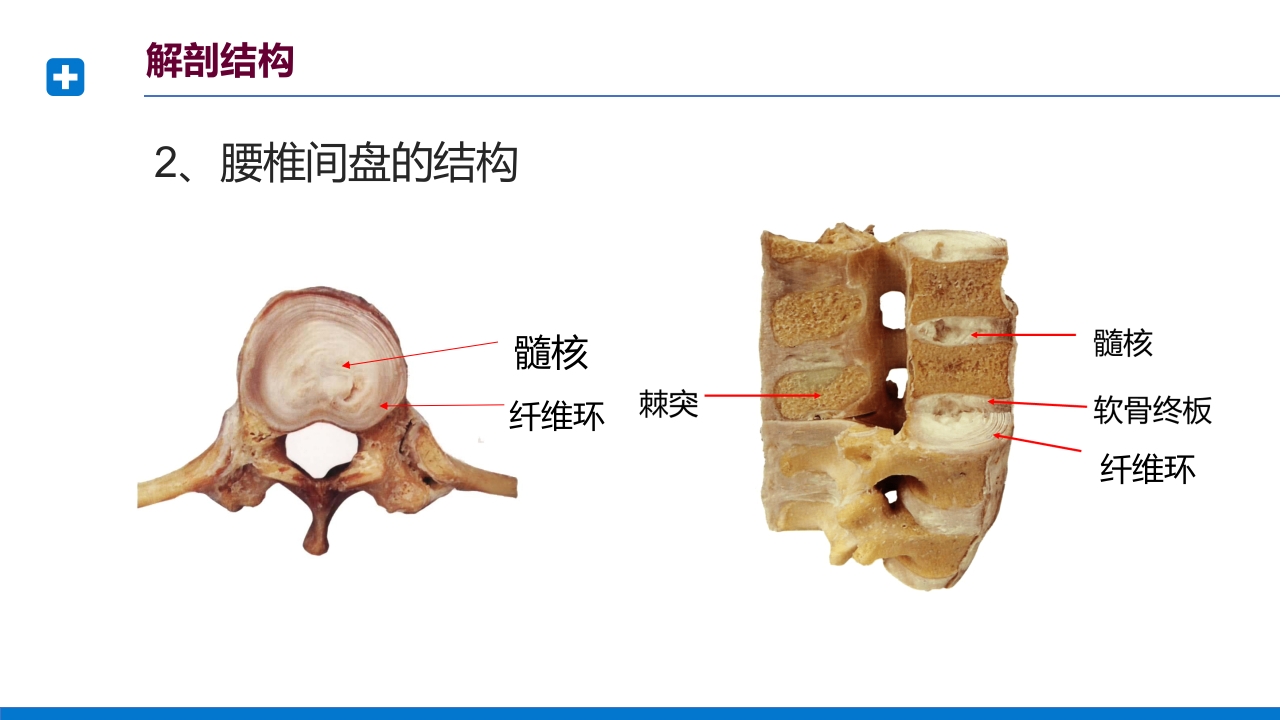 腰椎间盘突出症诊断与治疗PPT课件下载11