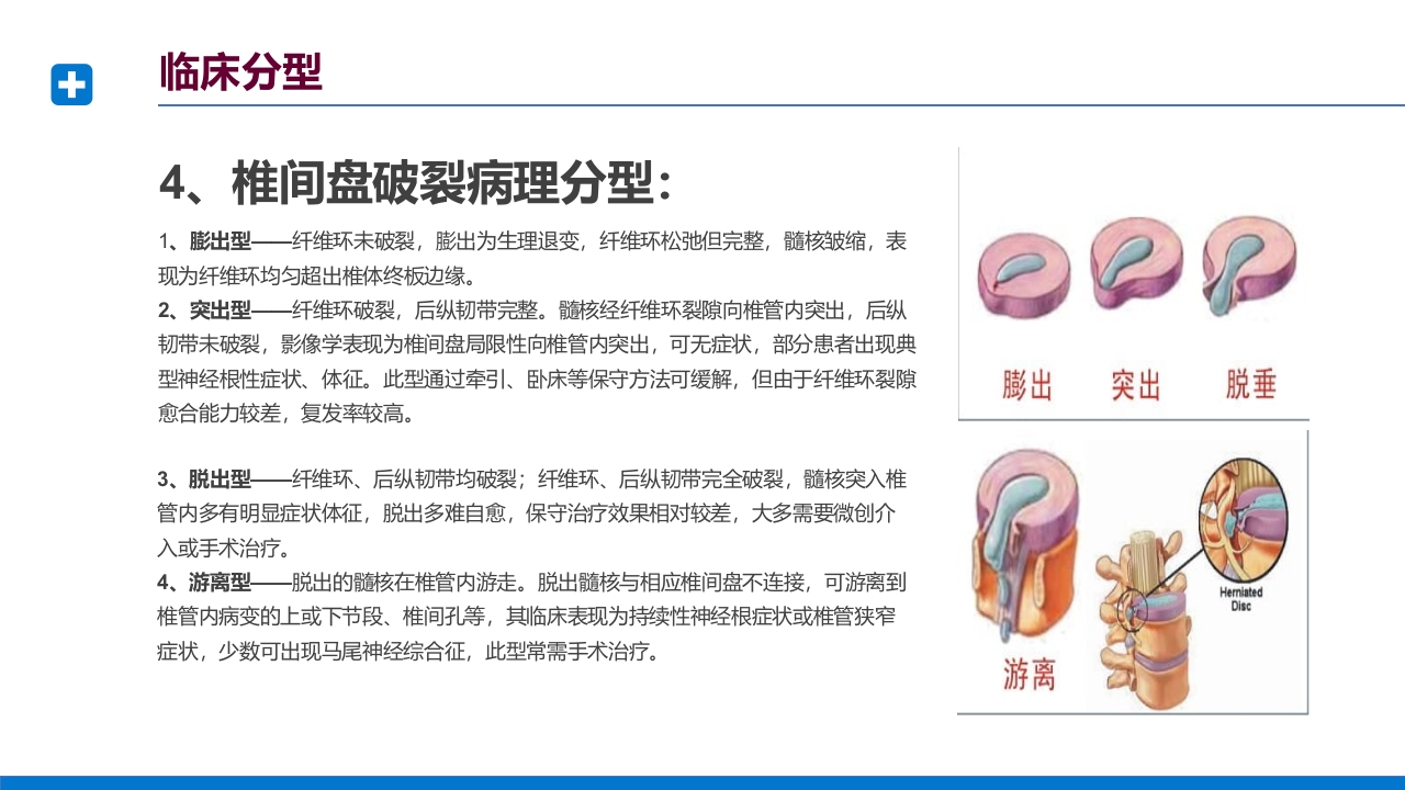 腰椎间盘突出症诊断与治疗PPT课件下载24