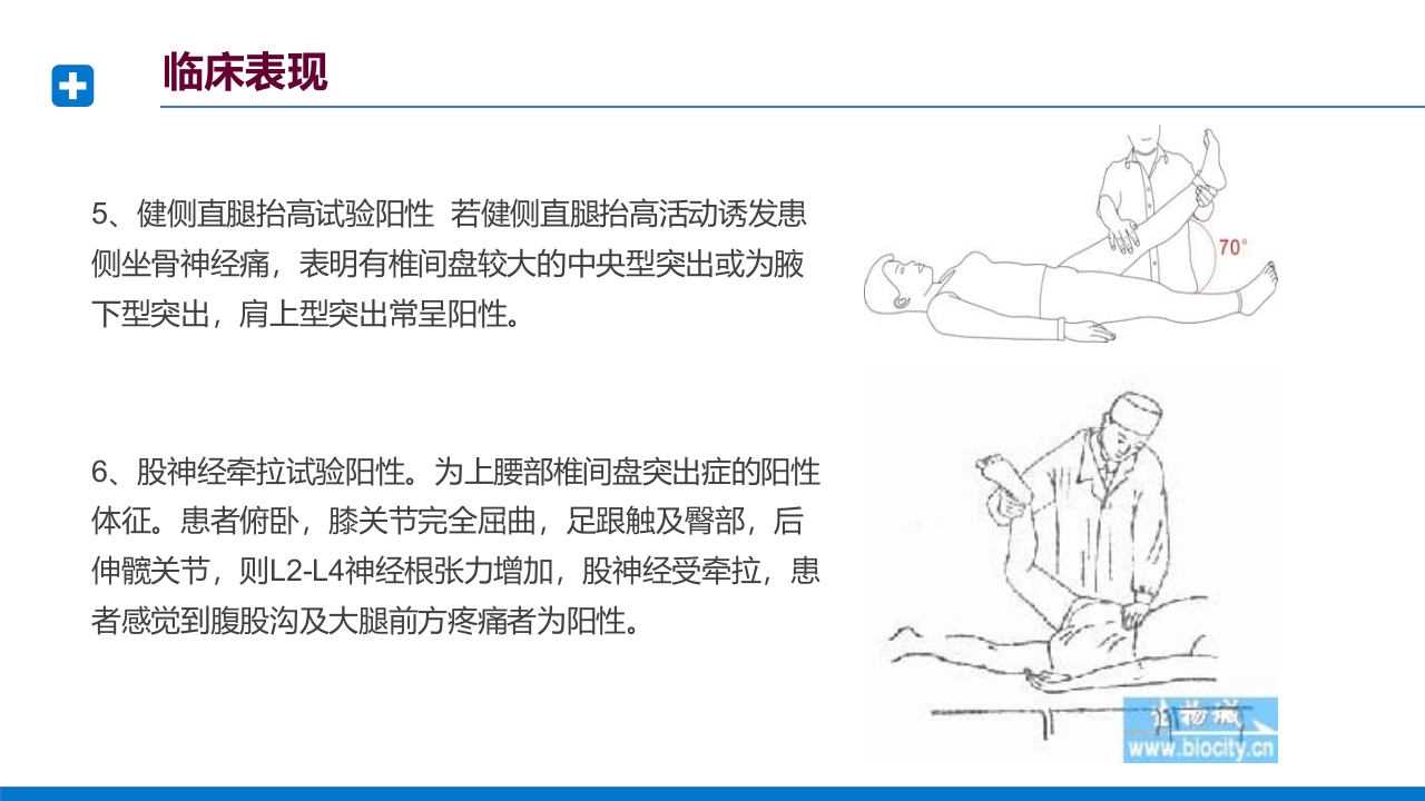 腰椎间盘突出症诊断与治疗PPT课件下载33