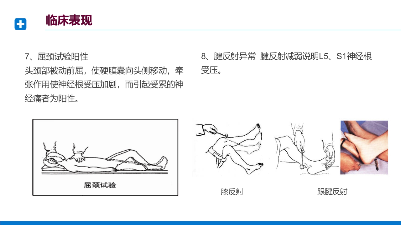 腰椎间盘突出症诊断与治疗PPT课件下载34