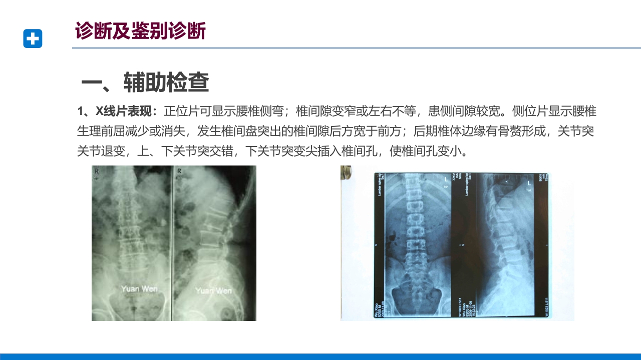 腰椎间盘突出症诊断与治疗PPT课件下载38