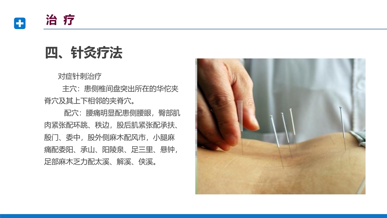 腰椎间盘突出症诊断与治疗PPT课件下载59