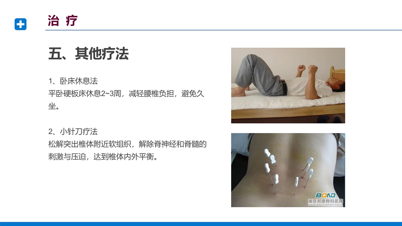 腰椎间盘突出症诊断与治疗PPT课件下载60